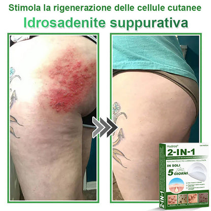 𝐇𝐮𝐝𝐫𝐨𝐬® 📌𝐂𝐞𝐫𝐨𝐭𝐭𝐢 𝐢𝐝𝐫𝐨𝐜𝐨𝐥𝐥𝐨𝐢𝐝𝐚𝐥𝐢 𝐜𝐨𝐧 𝐦𝐢𝐜𝐫𝐨𝐚𝐠𝐡𝐢 𝟐 𝐢𝐧 𝟏 | 𝐀𝐩𝐩𝐨𝐬𝐢𝐭𝐚𝐦𝐞𝐧𝐭𝐞 𝐬𝐯𝐢𝐥𝐮𝐩𝐩𝐚𝐭𝐢 𝐩𝐞𝐫 𝐥𝐚 𝐫𝐢𝐦𝐨𝐳𝐢𝐨𝐧𝐞 𝐝𝐢 𝐧𝐞𝐢 𝐬𝐩𝐨𝐫𝐠𝐞𝐧𝐭𝐢, 𝐚𝐜𝐧𝐞, 𝐯𝐞𝐫𝐫𝐮𝐜𝐡𝐞 𝐩𝐢𝐚𝐧𝐞 𝐞 𝐞𝐬𝐜𝐫𝐞𝐬𝐜𝐞𝐧𝐳𝐞 𝐜𝐮𝐭𝐚𝐧𝐞𝐞 | 𝐂𝐨𝐧𝐟𝐞𝐳𝐢𝐨𝐧𝐞 𝐝𝐚 𝟏𝟒𝟒 𝐩𝐞𝐳𝐳𝐢🪻🪻