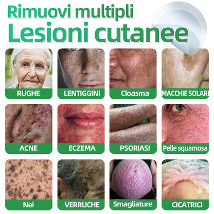 𝐇𝐮𝐝𝐫𝐨𝐬® 📌𝐂𝐞𝐫𝐨𝐭𝐭𝐢 𝐢𝐝𝐫𝐨𝐜𝐨𝐥𝐥𝐨𝐢𝐝𝐚𝐥𝐢 𝐜𝐨𝐧 𝐦𝐢𝐜𝐫𝐨𝐚𝐠𝐡𝐢 𝟐 𝐢𝐧 𝟏 | 𝐀𝐩𝐩𝐨𝐬𝐢𝐭𝐚𝐦𝐞𝐧𝐭𝐞 𝐬𝐯𝐢𝐥𝐮𝐩𝐩𝐚𝐭𝐢 𝐩𝐞𝐫 𝐥𝐚 𝐫𝐢𝐦𝐨𝐳𝐢𝐨𝐧𝐞 𝐝𝐢 𝐧𝐞𝐢 𝐬𝐩𝐨𝐫𝐠𝐞𝐧𝐭𝐢, 𝐚𝐜𝐧𝐞, 𝐯𝐞𝐫𝐫𝐮𝐜𝐡𝐞 𝐩𝐢𝐚𝐧𝐞 𝐞 𝐞𝐬𝐜𝐫𝐞𝐬𝐜𝐞𝐧𝐳𝐞 𝐜𝐮𝐭𝐚𝐧𝐞𝐞 | 𝐂𝐨𝐧𝐟𝐞𝐳𝐢𝐨𝐧𝐞 𝐝𝐚 𝟏𝟒𝟒 𝐩𝐞𝐳𝐳𝐢🪻🪻