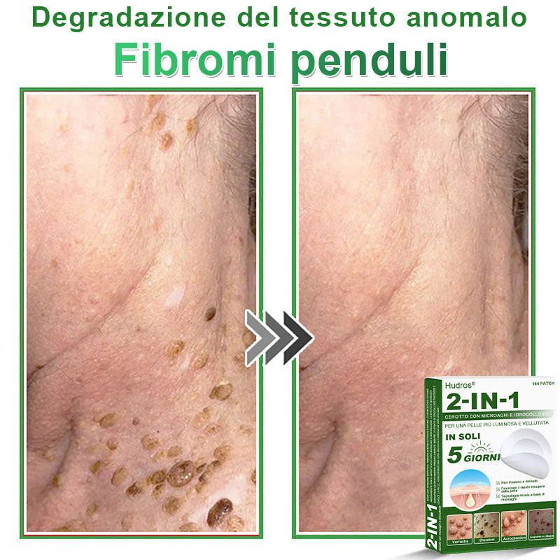 𝐇𝐮𝐝𝐫𝐨𝐬® 📌𝐂𝐞𝐫𝐨𝐭𝐭𝐢 𝐢𝐝𝐫𝐨𝐜𝐨𝐥𝐥𝐨𝐢𝐝𝐚𝐥𝐢 𝐜𝐨𝐧 𝐦𝐢𝐜𝐫𝐨𝐚𝐠𝐡𝐢 𝟐 𝐢𝐧 𝟏 | 𝐀𝐩𝐩𝐨𝐬𝐢𝐭𝐚𝐦𝐞𝐧𝐭𝐞 𝐬𝐯𝐢𝐥𝐮𝐩𝐩𝐚𝐭𝐢 𝐩𝐞𝐫 𝐥𝐚 𝐫𝐢𝐦𝐨𝐳𝐢𝐨𝐧𝐞 𝐝𝐢 𝐧𝐞𝐢 𝐬𝐩𝐨𝐫𝐠𝐞𝐧𝐭𝐢, 𝐚𝐜𝐧𝐞, 𝐯𝐞𝐫𝐫𝐮𝐜𝐡𝐞 𝐩𝐢𝐚𝐧𝐞 𝐞 𝐞𝐬𝐜𝐫𝐞𝐬𝐜𝐞𝐧𝐳𝐞 𝐜𝐮𝐭𝐚𝐧𝐞𝐞 | 𝐂𝐨𝐧𝐟𝐞𝐳𝐢𝐨𝐧𝐞 𝐝𝐚 𝟏𝟒𝟒 𝐩𝐞𝐳𝐳𝐢🪻🪻