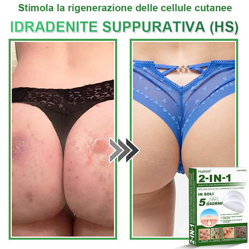 𝐇𝐮𝐝𝐫𝐨𝐬® 📌𝐂𝐞𝐫𝐨𝐭𝐭𝐢 𝐢𝐝𝐫𝐨𝐜𝐨𝐥𝐥𝐨𝐢𝐝𝐚𝐥𝐢 𝐜𝐨𝐧 𝐦𝐢𝐜𝐫𝐨𝐚𝐠𝐡𝐢 𝟐 𝐢𝐧 𝟏 | 𝐀𝐩𝐩𝐨𝐬𝐢𝐭𝐚𝐦𝐞𝐧𝐭𝐞 𝐬𝐯𝐢𝐥𝐮𝐩𝐩𝐚𝐭𝐢 𝐩𝐞𝐫 𝐥𝐚 𝐫𝐢𝐦𝐨𝐳𝐢𝐨𝐧𝐞 𝐝𝐢 𝐧𝐞𝐢 𝐬𝐩𝐨𝐫𝐠𝐞𝐧𝐭𝐢, 𝐚𝐜𝐧𝐞, 𝐯𝐞𝐫𝐫𝐮𝐜𝐡𝐞 𝐩𝐢𝐚𝐧𝐞 𝐞 𝐞𝐬𝐜𝐫𝐞𝐬𝐜𝐞𝐧𝐳𝐞 𝐜𝐮𝐭𝐚𝐧𝐞𝐞 | 𝐂𝐨𝐧𝐟𝐞𝐳𝐢𝐨𝐧𝐞 𝐝𝐚 𝟏𝟒𝟒 𝐩𝐞𝐳𝐳𝐢🪻🪻