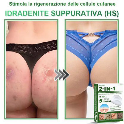 𝐇𝐮𝐝𝐫𝐨𝐬® 📌𝐂𝐞𝐫𝐨𝐭𝐭𝐢 𝐢𝐝𝐫𝐨𝐜𝐨𝐥𝐥𝐨𝐢𝐝𝐚𝐥𝐢 𝐜𝐨𝐧 𝐦𝐢𝐜𝐫𝐨𝐚𝐠𝐡𝐢 𝟐 𝐢𝐧 𝟏 | 𝐀𝐩𝐩𝐨𝐬𝐢𝐭𝐚𝐦𝐞𝐧𝐭𝐞 𝐬𝐯𝐢𝐥𝐮𝐩𝐩𝐚𝐭𝐢 𝐩𝐞𝐫 𝐥𝐚 𝐫𝐢𝐦𝐨𝐳𝐢𝐨𝐧𝐞 𝐝𝐢 𝐧𝐞𝐢 𝐬𝐩𝐨𝐫𝐠𝐞𝐧𝐭𝐢, 𝐚𝐜𝐧𝐞, 𝐯𝐞𝐫𝐫𝐮𝐜𝐡𝐞 𝐩𝐢𝐚𝐧𝐞 𝐞 𝐞𝐬𝐜𝐫𝐞𝐬𝐜𝐞𝐧𝐳𝐞 𝐜𝐮𝐭𝐚𝐧𝐞𝐞 | 𝐂𝐨𝐧𝐟𝐞𝐳𝐢𝐨𝐧𝐞 𝐝𝐚 𝟏𝟒𝟒 𝐩𝐞𝐳𝐳𝐢🪻🪻