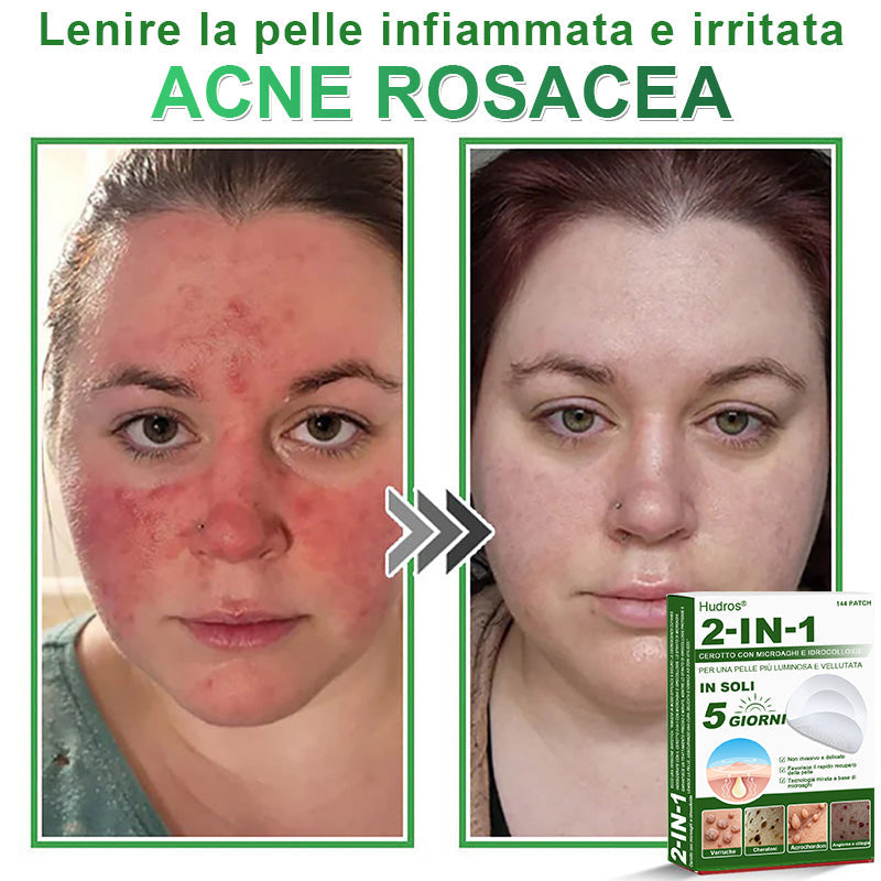 𝐇𝐮𝐝𝐫𝐨𝐬® 📌𝐂𝐞𝐫𝐨𝐭𝐭𝐢 𝐢𝐝𝐫𝐨𝐜𝐨𝐥𝐥𝐨𝐢𝐝𝐚𝐥𝐢 𝐜𝐨𝐧 𝐦𝐢𝐜𝐫𝐨𝐚𝐠𝐡𝐢 𝟐 𝐢𝐧 𝟏 | 𝐀𝐩𝐩𝐨𝐬𝐢𝐭𝐚𝐦𝐞𝐧𝐭𝐞 𝐬𝐯𝐢𝐥𝐮𝐩𝐩𝐚𝐭𝐢 𝐩𝐞𝐫 𝐥𝐚 𝐫𝐢𝐦𝐨𝐳𝐢𝐨𝐧𝐞 𝐝𝐢 𝐧𝐞𝐢 𝐬𝐩𝐨𝐫𝐠𝐞𝐧𝐭𝐢, 𝐚𝐜𝐧𝐞, 𝐯𝐞𝐫𝐫𝐮𝐜𝐡𝐞 𝐩𝐢𝐚𝐧𝐞 𝐞 𝐞𝐬𝐜𝐫𝐞𝐬𝐜𝐞𝐧𝐳𝐞 𝐜𝐮𝐭𝐚𝐧𝐞𝐞 | 𝐂𝐨𝐧𝐟𝐞𝐳𝐢𝐨𝐧𝐞 𝐝𝐚 𝟏𝟒𝟒 𝐩𝐞𝐳𝐳𝐢🪻🪻