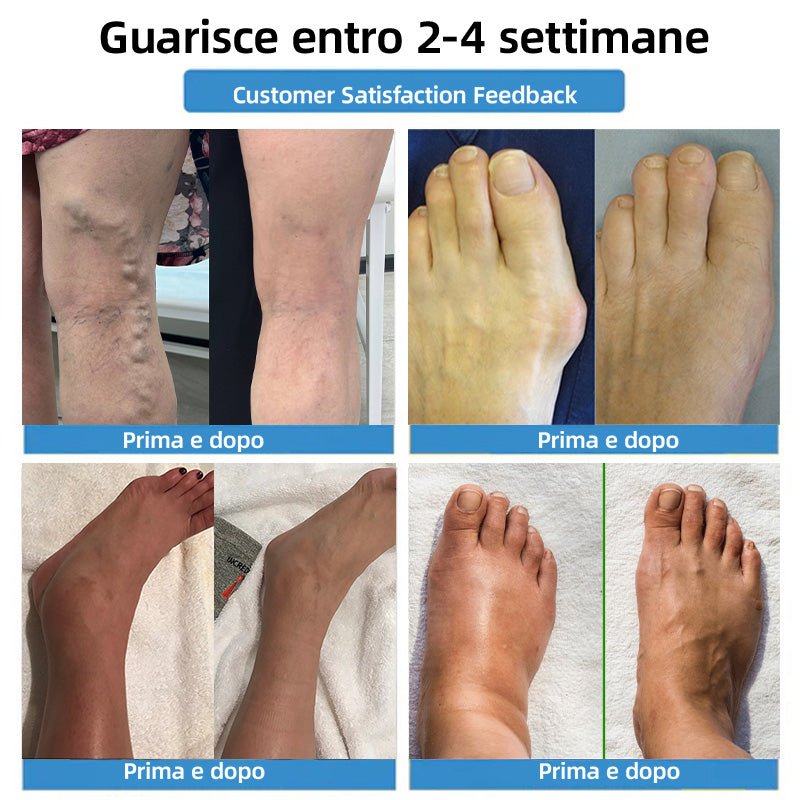 OFFERTA LIMITATA -80%｜𝐇𝐞𝐚𝐥𝐫𝐢𝐳𝐞® Cerotti Nano Microneedle 4-in-1 per Vene e Articolazioni 👍 Sollievo rapido, risultati duraturi