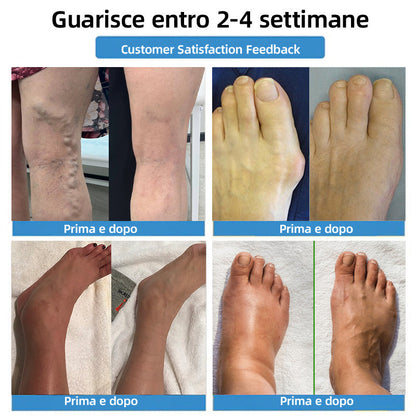 OFFERTA LIMITATA -80%｜𝐇𝐞𝐚𝐥𝐫𝐢𝐳𝐞® Cerotti Nano Microneedle 4-in-1 per Vene e Articolazioni 👍 Sollievo rapido, risultati duraturi
