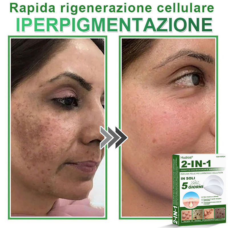 𝐇𝐮𝐝𝐫𝐨𝐬® 📌𝐂𝐞𝐫𝐨𝐭𝐭𝐢 𝐢𝐝𝐫𝐨𝐜𝐨𝐥𝐥𝐨𝐢𝐝𝐚𝐥𝐢 𝐜𝐨𝐧 𝐦𝐢𝐜𝐫𝐨𝐚𝐠𝐡𝐢 𝟐 𝐢𝐧 𝟏 | 𝐀𝐩𝐩𝐨𝐬𝐢𝐭𝐚𝐦𝐞𝐧𝐭𝐞 𝐬𝐯𝐢𝐥𝐮𝐩𝐩𝐚𝐭𝐢 𝐩𝐞𝐫 𝐥𝐚 𝐫𝐢𝐦𝐨𝐳𝐢𝐨𝐧𝐞 𝐝𝐢 𝐧𝐞𝐢 𝐬𝐩𝐨𝐫𝐠𝐞𝐧𝐭𝐢, 𝐚𝐜𝐧𝐞, 𝐯𝐞𝐫𝐫𝐮𝐜𝐡𝐞 𝐩𝐢𝐚𝐧𝐞 𝐞 𝐞𝐬𝐜𝐫𝐞𝐬𝐜𝐞𝐧𝐳𝐞 𝐜𝐮𝐭𝐚𝐧𝐞𝐞 | 𝐂𝐨𝐧𝐟𝐞𝐳𝐢𝐨𝐧𝐞 𝐝𝐚 𝟏𝟒𝟒 𝐩𝐞𝐳𝐳𝐢🪻🪻