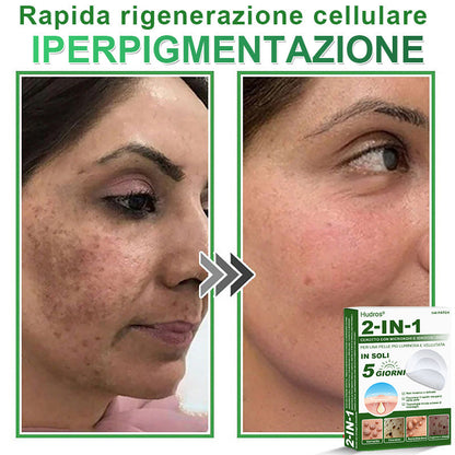 𝐇𝐮𝐝𝐫𝐨𝐬® 📌𝐂𝐞𝐫𝐨𝐭𝐭𝐢 𝐢𝐝𝐫𝐨𝐜𝐨𝐥𝐥𝐨𝐢𝐝𝐚𝐥𝐢 𝐜𝐨𝐧 𝐦𝐢𝐜𝐫𝐨𝐚𝐠𝐡𝐢 𝟐 𝐢𝐧 𝟏 | 𝐀𝐩𝐩𝐨𝐬𝐢𝐭𝐚𝐦𝐞𝐧𝐭𝐞 𝐬𝐯𝐢𝐥𝐮𝐩𝐩𝐚𝐭𝐢 𝐩𝐞𝐫 𝐥𝐚 𝐫𝐢𝐦𝐨𝐳𝐢𝐨𝐧𝐞 𝐝𝐢 𝐧𝐞𝐢 𝐬𝐩𝐨𝐫𝐠𝐞𝐧𝐭𝐢, 𝐚𝐜𝐧𝐞, 𝐯𝐞𝐫𝐫𝐮𝐜𝐡𝐞 𝐩𝐢𝐚𝐧𝐞 𝐞 𝐞𝐬𝐜𝐫𝐞𝐬𝐜𝐞𝐧𝐳𝐞 𝐜𝐮𝐭𝐚𝐧𝐞𝐞 | 𝐂𝐨𝐧𝐟𝐞𝐳𝐢𝐨𝐧𝐞 𝐝𝐚 𝟏𝟒𝟒 𝐩𝐞𝐳𝐳𝐢🪻🪻