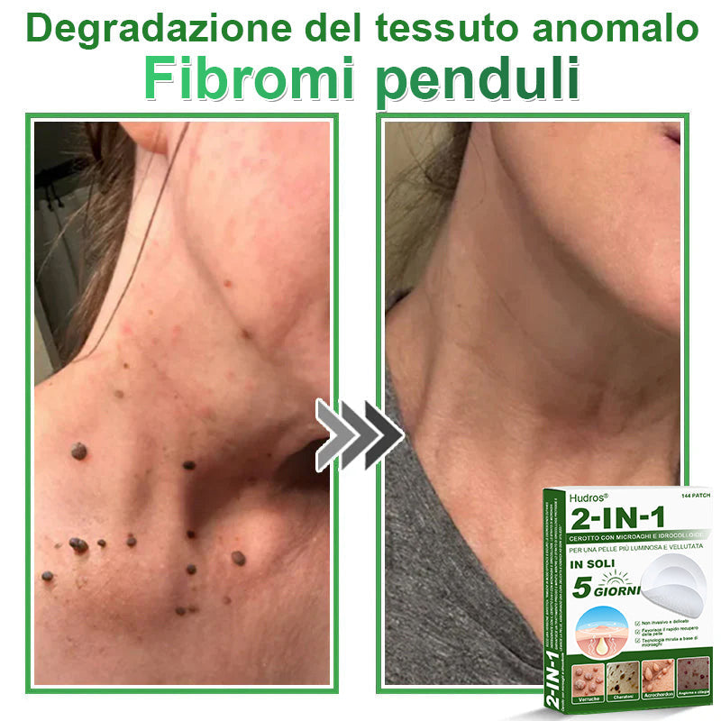 𝐇𝐮𝐝𝐫𝐨𝐬® 📌𝐂𝐞𝐫𝐨𝐭𝐭𝐢 𝐢𝐝𝐫𝐨𝐜𝐨𝐥𝐥𝐨𝐢𝐝𝐚𝐥𝐢 𝐜𝐨𝐧 𝐦𝐢𝐜𝐫𝐨𝐚𝐠𝐡𝐢 𝟐 𝐢𝐧 𝟏 | 𝐀𝐩𝐩𝐨𝐬𝐢𝐭𝐚𝐦𝐞𝐧𝐭𝐞 𝐬𝐯𝐢𝐥𝐮𝐩𝐩𝐚𝐭𝐢 𝐩𝐞𝐫 𝐥𝐚 𝐫𝐢𝐦𝐨𝐳𝐢𝐨𝐧𝐞 𝐝𝐢 𝐧𝐞𝐢 𝐬𝐩𝐨𝐫𝐠𝐞𝐧𝐭𝐢, 𝐚𝐜𝐧𝐞, 𝐯𝐞𝐫𝐫𝐮𝐜𝐡𝐞 𝐩𝐢𝐚𝐧𝐞 𝐞 𝐞𝐬𝐜𝐫𝐞𝐬𝐜𝐞𝐧𝐳𝐞 𝐜𝐮𝐭𝐚𝐧𝐞𝐞 | 𝐂𝐨𝐧𝐟𝐞𝐳𝐢𝐨𝐧𝐞 𝐝𝐚 𝟏𝟒𝟒 𝐩𝐞𝐳𝐳𝐢🪻🪻