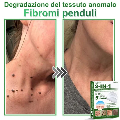𝐇𝐮𝐝𝐫𝐨𝐬® 📌𝐂𝐞𝐫𝐨𝐭𝐭𝐢 𝐢𝐝𝐫𝐨𝐜𝐨𝐥𝐥𝐨𝐢𝐝𝐚𝐥𝐢 𝐜𝐨𝐧 𝐦𝐢𝐜𝐫𝐨𝐚𝐠𝐡𝐢 𝟐 𝐢𝐧 𝟏 | 𝐀𝐩𝐩𝐨𝐬𝐢𝐭𝐚𝐦𝐞𝐧𝐭𝐞 𝐬𝐯𝐢𝐥𝐮𝐩𝐩𝐚𝐭𝐢 𝐩𝐞𝐫 𝐥𝐚 𝐫𝐢𝐦𝐨𝐳𝐢𝐨𝐧𝐞 𝐝𝐢 𝐧𝐞𝐢 𝐬𝐩𝐨𝐫𝐠𝐞𝐧𝐭𝐢, 𝐚𝐜𝐧𝐞, 𝐯𝐞𝐫𝐫𝐮𝐜𝐡𝐞 𝐩𝐢𝐚𝐧𝐞 𝐞 𝐞𝐬𝐜𝐫𝐞𝐬𝐜𝐞𝐧𝐳𝐞 𝐜𝐮𝐭𝐚𝐧𝐞𝐞 | 𝐂𝐨𝐧𝐟𝐞𝐳𝐢𝐨𝐧𝐞 𝐝𝐚 𝟏𝟒𝟒 𝐩𝐞𝐳𝐳𝐢🪻🪻