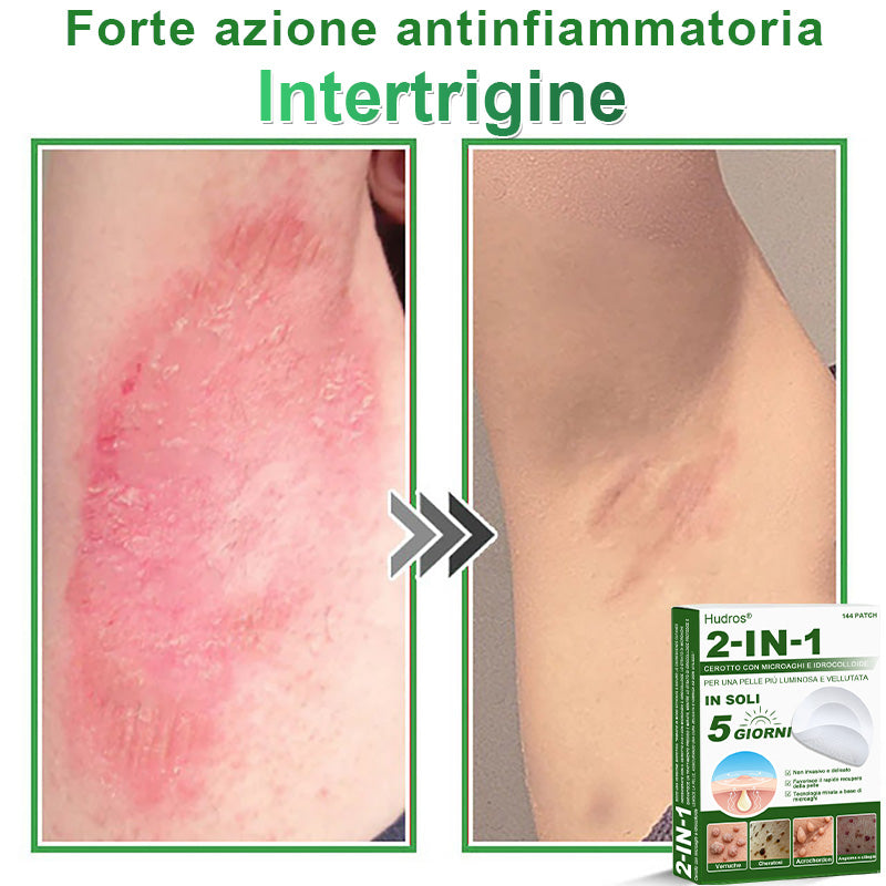 𝐇𝐮𝐝𝐫𝐨𝐬® 📌𝐂𝐞𝐫𝐨𝐭𝐭𝐢 𝐢𝐝𝐫𝐨𝐜𝐨𝐥𝐥𝐨𝐢𝐝𝐚𝐥𝐢 𝐜𝐨𝐧 𝐦𝐢𝐜𝐫𝐨𝐚𝐠𝐡𝐢 𝟐 𝐢𝐧 𝟏 | 𝐀𝐩𝐩𝐨𝐬𝐢𝐭𝐚𝐦𝐞𝐧𝐭𝐞 𝐬𝐯𝐢𝐥𝐮𝐩𝐩𝐚𝐭𝐢 𝐩𝐞𝐫 𝐥𝐚 𝐫𝐢𝐦𝐨𝐳𝐢𝐨𝐧𝐞 𝐝𝐢 𝐧𝐞𝐢 𝐬𝐩𝐨𝐫𝐠𝐞𝐧𝐭𝐢, 𝐚𝐜𝐧𝐞, 𝐯𝐞𝐫𝐫𝐮𝐜𝐡𝐞 𝐩𝐢𝐚𝐧𝐞 𝐞 𝐞𝐬𝐜𝐫𝐞𝐬𝐜𝐞𝐧𝐳𝐞 𝐜𝐮𝐭𝐚𝐧𝐞𝐞 | 𝐂𝐨𝐧𝐟𝐞𝐳𝐢𝐨𝐧𝐞 𝐝𝐚 𝟏𝟒𝟒 𝐩𝐞𝐳𝐳𝐢🪻🪻