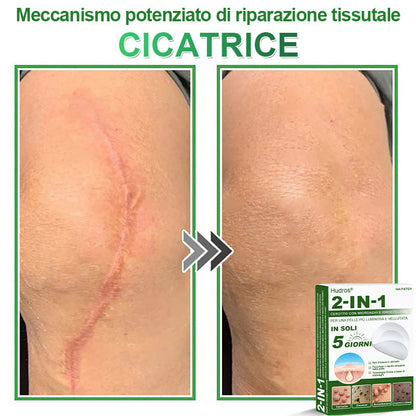 𝐇𝐮𝐝𝐫𝐨𝐬® 📌𝐂𝐞𝐫𝐨𝐭𝐭𝐢 𝐢𝐝𝐫𝐨𝐜𝐨𝐥𝐥𝐨𝐢𝐝𝐚𝐥𝐢 𝐜𝐨𝐧 𝐦𝐢𝐜𝐫𝐨𝐚𝐠𝐡𝐢 𝟐 𝐢𝐧 𝟏 | 𝐀𝐩𝐩𝐨𝐬𝐢𝐭𝐚𝐦𝐞𝐧𝐭𝐞 𝐬𝐯𝐢𝐥𝐮𝐩𝐩𝐚𝐭𝐢 𝐩𝐞𝐫 𝐥𝐚 𝐫𝐢𝐦𝐨𝐳𝐢𝐨𝐧𝐞 𝐝𝐢 𝐧𝐞𝐢 𝐬𝐩𝐨𝐫𝐠𝐞𝐧𝐭𝐢, 𝐚𝐜𝐧𝐞, 𝐯𝐞𝐫𝐫𝐮𝐜𝐡𝐞 𝐩𝐢𝐚𝐧𝐞 𝐞 𝐞𝐬𝐜𝐫𝐞𝐬𝐜𝐞𝐧𝐳𝐞 𝐜𝐮𝐭𝐚𝐧𝐞𝐞 | 𝐂𝐨𝐧𝐟𝐞𝐳𝐢𝐨𝐧𝐞 𝐝𝐚 𝟏𝟒𝟒 𝐩𝐞𝐳𝐳𝐢🪻🪻