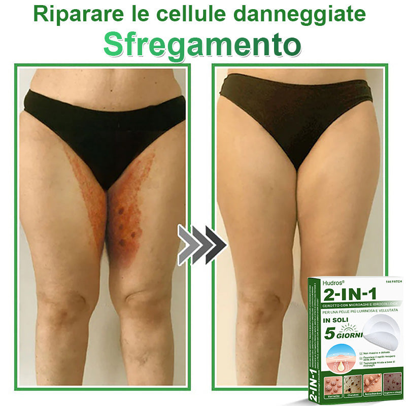 𝐇𝐮𝐝𝐫𝐨𝐬® 📌𝐂𝐞𝐫𝐨𝐭𝐭𝐢 𝐢𝐝𝐫𝐨𝐜𝐨𝐥𝐥𝐨𝐢𝐝𝐚𝐥𝐢 𝐜𝐨𝐧 𝐦𝐢𝐜𝐫𝐨𝐚𝐠𝐡𝐢 𝟐 𝐢𝐧 𝟏 | 𝐀𝐩𝐩𝐨𝐬𝐢𝐭𝐚𝐦𝐞𝐧𝐭𝐞 𝐬𝐯𝐢𝐥𝐮𝐩𝐩𝐚𝐭𝐢 𝐩𝐞𝐫 𝐥𝐚 𝐫𝐢𝐦𝐨𝐳𝐢𝐨𝐧𝐞 𝐝𝐢 𝐧𝐞𝐢 𝐬𝐩𝐨𝐫𝐠𝐞𝐧𝐭𝐢, 𝐚𝐜𝐧𝐞, 𝐯𝐞𝐫𝐫𝐮𝐜𝐡𝐞 𝐩𝐢𝐚𝐧𝐞 𝐞 𝐞𝐬𝐜𝐫𝐞𝐬𝐜𝐞𝐧𝐳𝐞 𝐜𝐮𝐭𝐚𝐧𝐞𝐞 | 𝐂𝐨𝐧𝐟𝐞𝐳𝐢𝐨𝐧𝐞 𝐝𝐚 𝟏𝟒𝟒 𝐩𝐞𝐳𝐳𝐢🪻🪻
