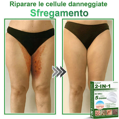 𝐇𝐮𝐝𝐫𝐨𝐬® 📌𝐂𝐞𝐫𝐨𝐭𝐭𝐢 𝐢𝐝𝐫𝐨𝐜𝐨𝐥𝐥𝐨𝐢𝐝𝐚𝐥𝐢 𝐜𝐨𝐧 𝐦𝐢𝐜𝐫𝐨𝐚𝐠𝐡𝐢 𝟐 𝐢𝐧 𝟏 | 𝐀𝐩𝐩𝐨𝐬𝐢𝐭𝐚𝐦𝐞𝐧𝐭𝐞 𝐬𝐯𝐢𝐥𝐮𝐩𝐩𝐚𝐭𝐢 𝐩𝐞𝐫 𝐥𝐚 𝐫𝐢𝐦𝐨𝐳𝐢𝐨𝐧𝐞 𝐝𝐢 𝐧𝐞𝐢 𝐬𝐩𝐨𝐫𝐠𝐞𝐧𝐭𝐢, 𝐚𝐜𝐧𝐞, 𝐯𝐞𝐫𝐫𝐮𝐜𝐡𝐞 𝐩𝐢𝐚𝐧𝐞 𝐞 𝐞𝐬𝐜𝐫𝐞𝐬𝐜𝐞𝐧𝐳𝐞 𝐜𝐮𝐭𝐚𝐧𝐞𝐞 | 𝐂𝐨𝐧𝐟𝐞𝐳𝐢𝐨𝐧𝐞 𝐝𝐚 𝟏𝟒𝟒 𝐩𝐞𝐳𝐳𝐢🪻🪻